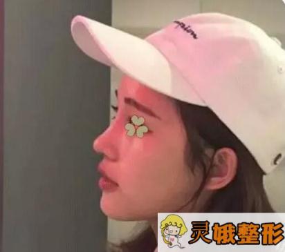 术后果展示