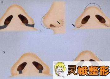 深圳唯美星整形医院简介