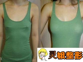 张元龙整形医生怎么样？技术好不好？