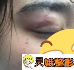西安市中心医院整形科口碑怎么样？价格表新版及祛疤案例