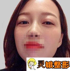 西安市中心医院整形科口碑怎么样？价格表新版及祛疤案例