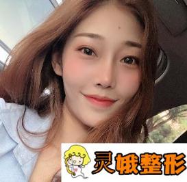 杭州阅美(原同欣)整形医院价格表，附眼部手术真实案例