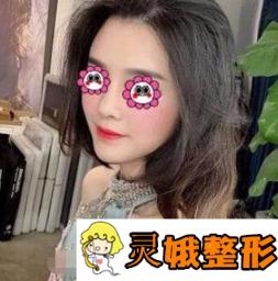 南昌大学第二附属医院整形科价格表曝光，附玻尿酸隆鼻案例