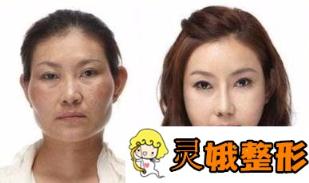 【关注】整形已成趋势？“颜值经济”走红？