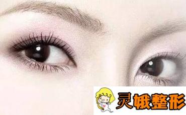 【需警惕】双眼皮手术虽普遍，但美丽和风险并存