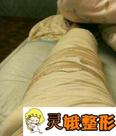 中南大学湘雅医院整形科价格表明细出炉，附案例展示