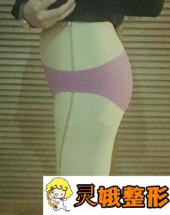 中南大学湘雅医院整形科价格表明细出炉，附案例展示