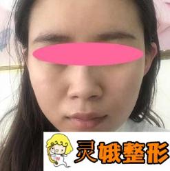 南阳美莱整形医院削骨 