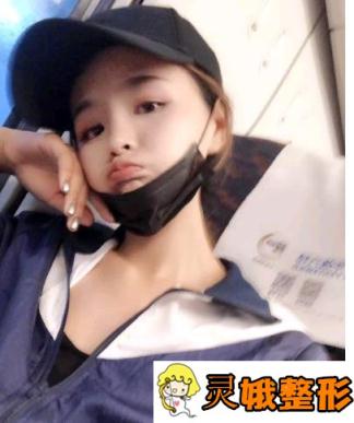 无锡爱思特整形价格表详细一览，附假体隆胸真人案例