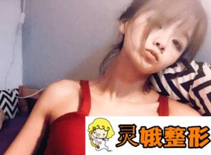 无锡爱思特整形价格表详细一览，附假体隆胸真人案例