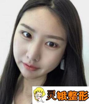 贵阳利美康价格表震撼出炉_双眼皮真人日记_医院概况