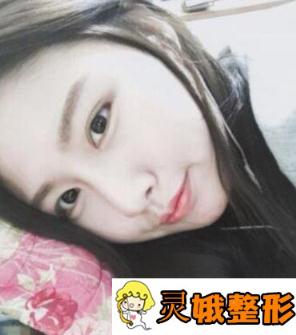 贵阳利美康价格表震撼出炉_双眼皮真人日记_医院概况