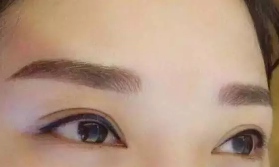 纹眉手术有哪些分类？