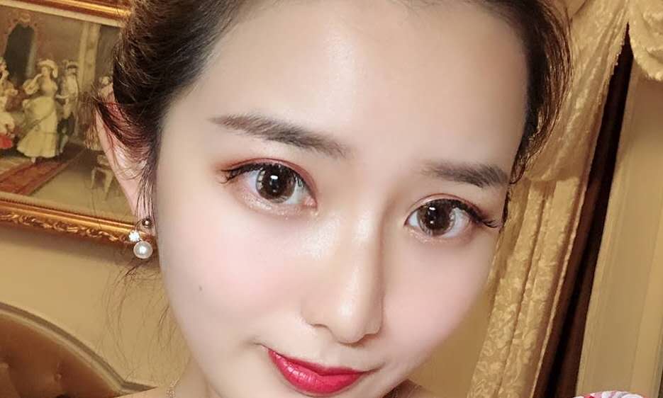 玻尿酸注射隆鼻能维持多长时间？