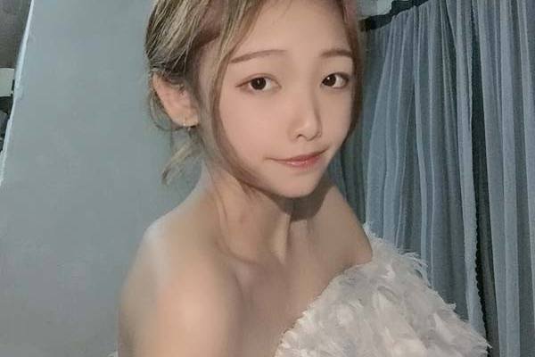福州省立医院整形外科面部吸脂案例