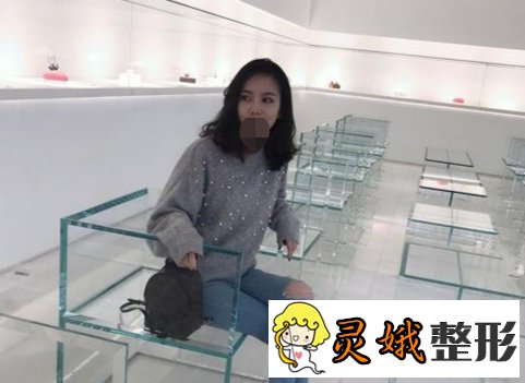 【案例】光乳化去眼袋果怎么样？原来去眼袋手术可以这样做啊！