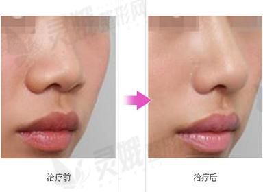QQ浏览器截图20210817213741.png