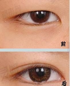 src=http___cdn.120askimages.com_ask_upload_zxmr_art_201401_201401011527587402.jpg&refer=http___cdn.120askimages.jpg