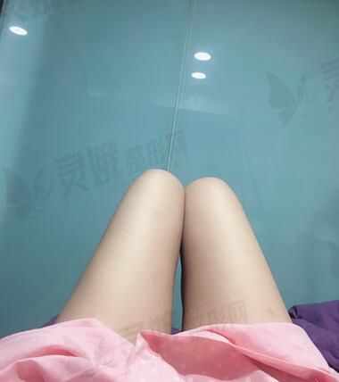 光子脱毛果图