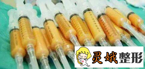 脂肪填充副作用有哪些?