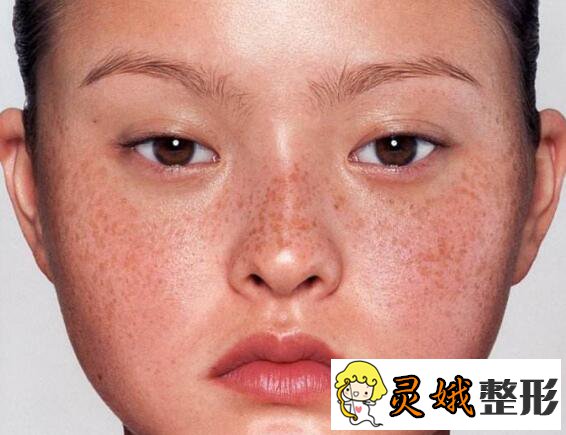 带头风范祛斑|【2020】郑大一附院整形科好的医生评选出炉，价格表