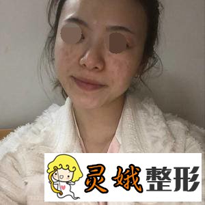 黄志祥医生，为众多爱美女性带来了福音！