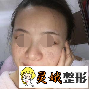 黄志祥医生，为众多爱美女性带来了福音！