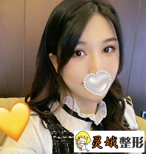 填充术后二个月