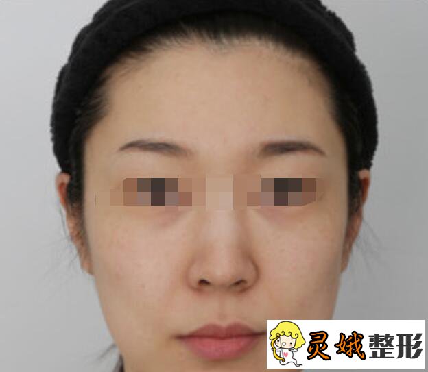 老是纹眉的果有什么不好