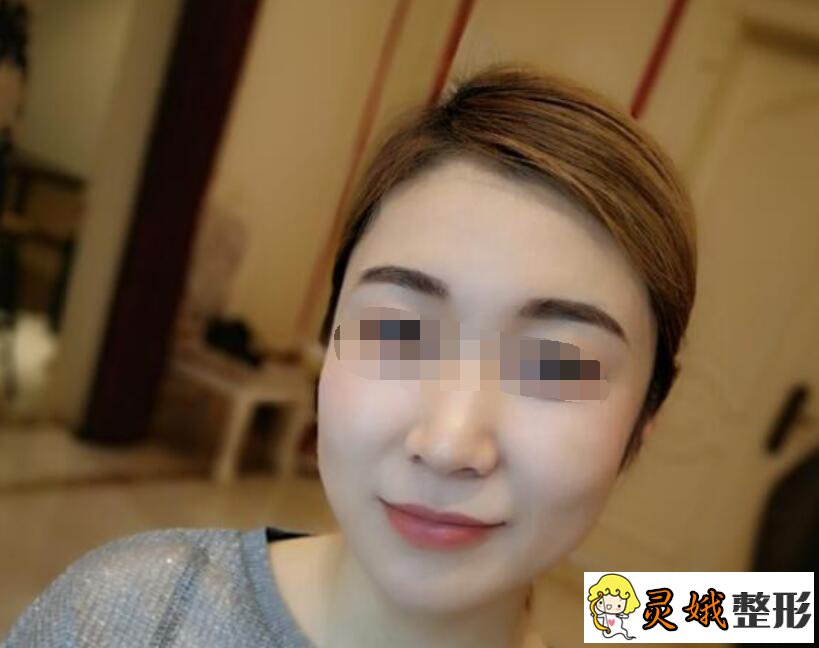 总算做完纹眉一个多月了