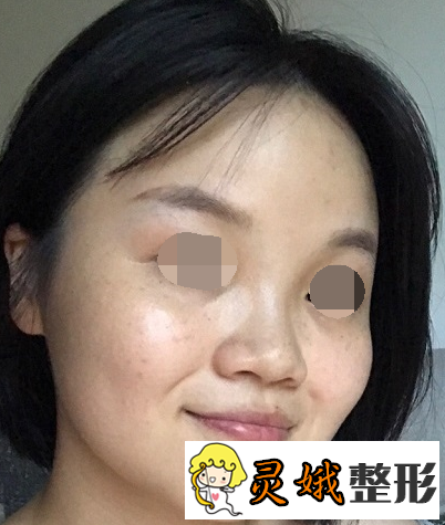 李红医生 长春铭医整形,想去做个面部除皱不知道怎么样呢？