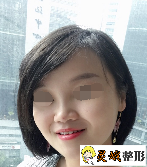 李红医生 长春铭医整形,想去做个面部除皱不知道怎么样呢？