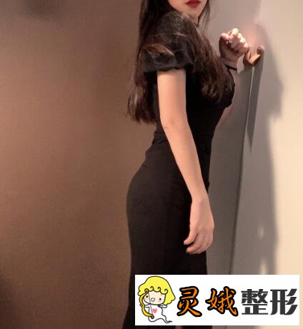 汕头华美整形医院朱洙玉医生吸脂瘦身后