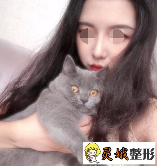 上海九院整形价格表,想做隆鼻手术，上海九院靠谱吗？