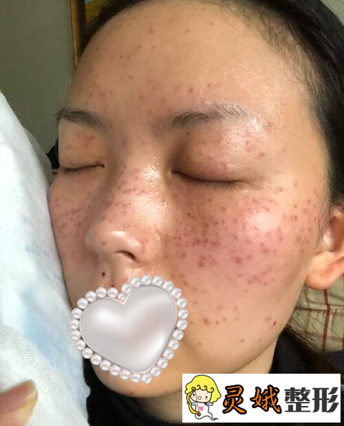 福州武警整形医院