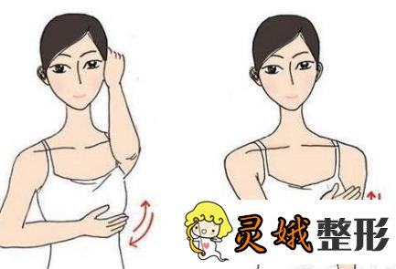 南昌方大医疗整形丰胸怎么样?丰胸案例在这里