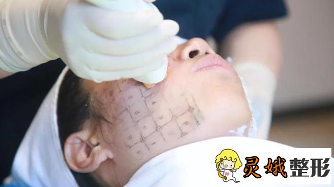 八大处王欢肋骨鼻子怎么样?隆鼻案例