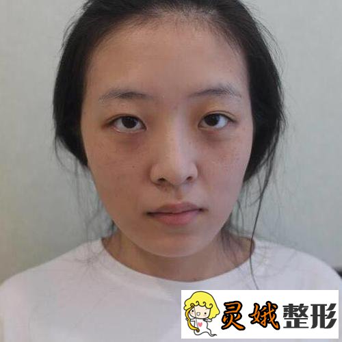 韩国卢相勋整形外科卢相勋医生技术怎么样?