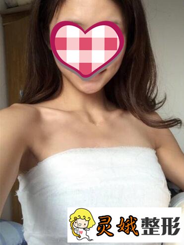 娜高假体隆胸果好不好?娜高假体隆胸案例