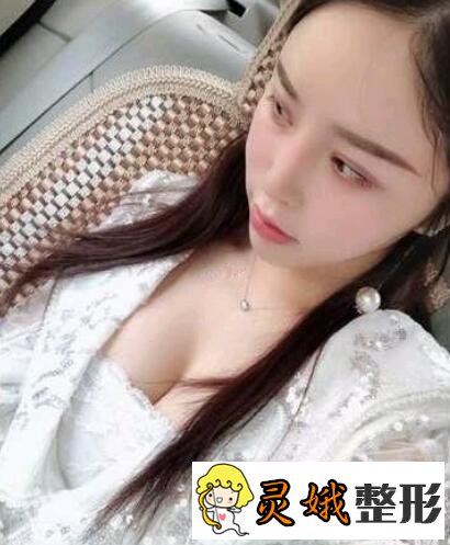 娜高假体隆胸果好不好?娜高假体隆胸案例