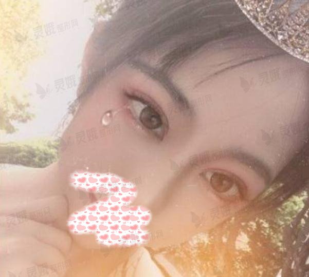 兰州大学第二医院眼科陈盛举近视矫正反馈，从此视野不再“模糊”！