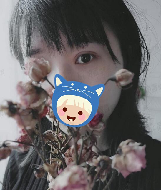 西南医院整形科陈亮双眼皮怎么样？术后案例30天遇见“美眼”