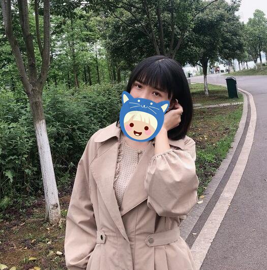 西南医院整形科陈亮双眼皮怎么样？术后案例30天遇见“美眼”