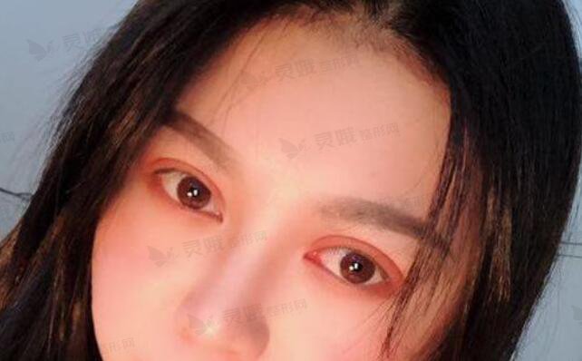 手术之后