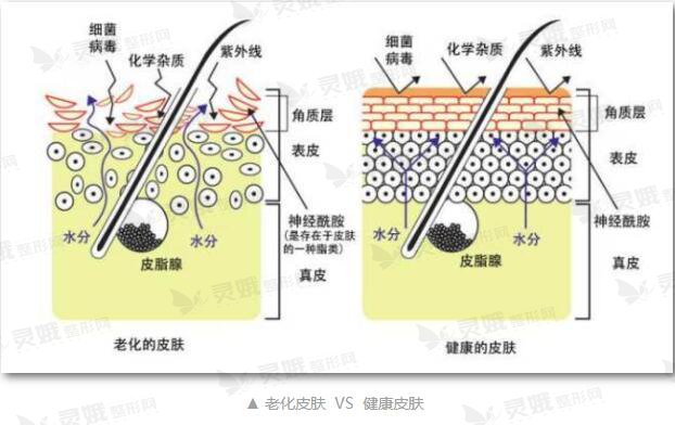 水光补水注射后的注意事项