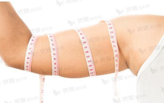 胳膊吸脂