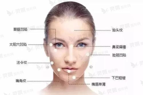 打玻尿酸多少钱一针