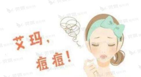 科学祛痘的方法告诉你