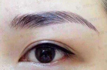 芭比眼部手术适合哪些人？打造芭比眼手术的3个关键项目，赶紧看看！