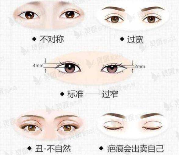 做双眼皮修复的价格是多少